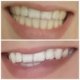 Luxx Amour Teeth Whitener photo review